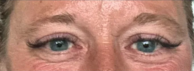 Client 1, before permanent brows by Natural Brows by Jenn in Franklin, TN